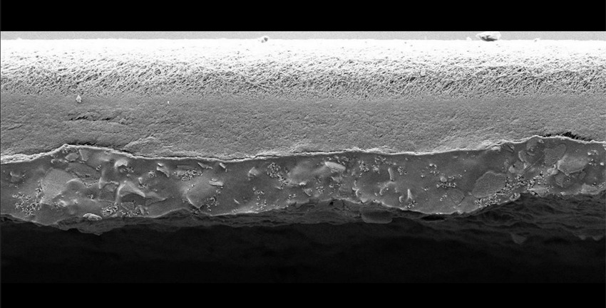 {instead}: trio vs Membranoids
